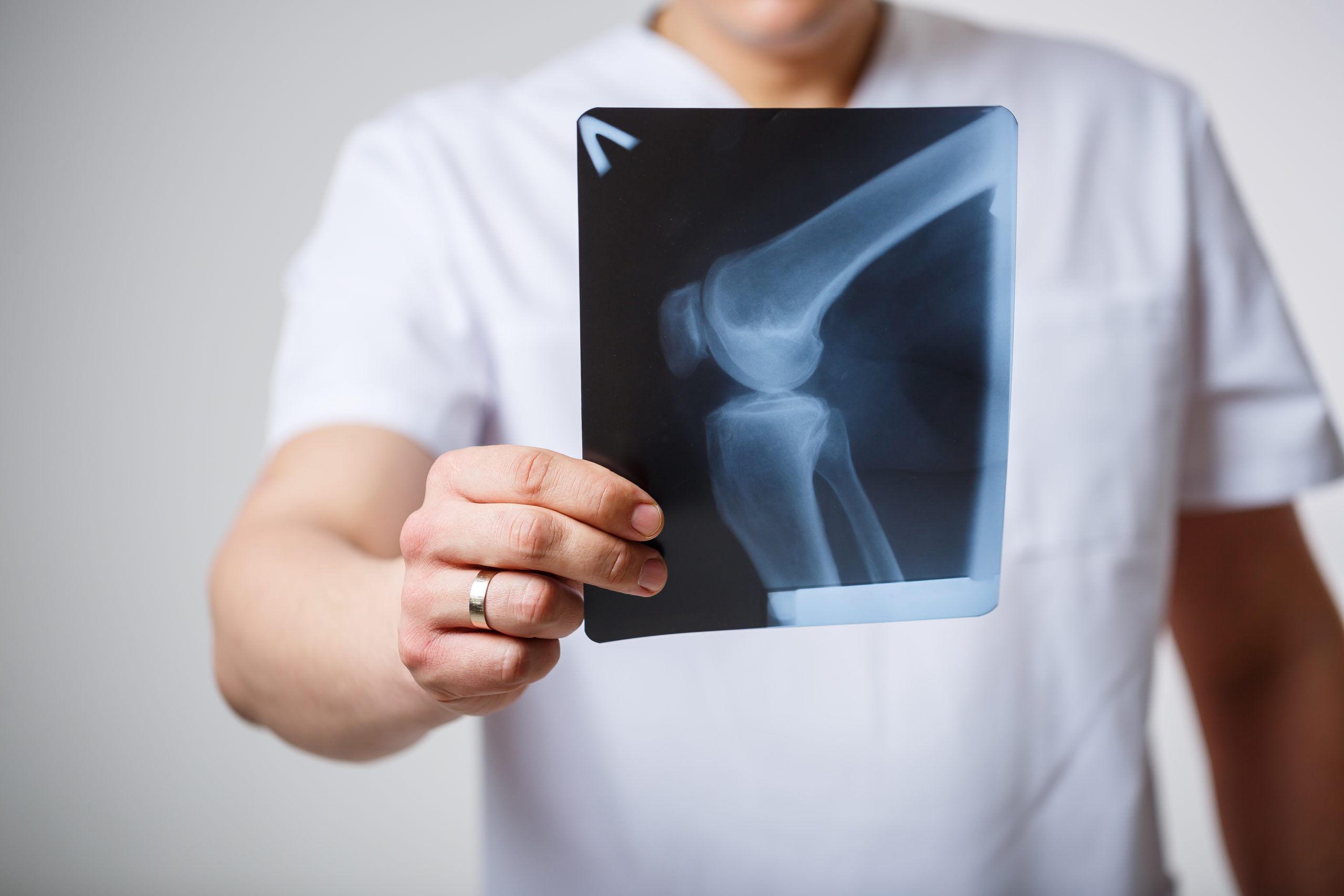 SAC X-Rays, MRI, and Angiography